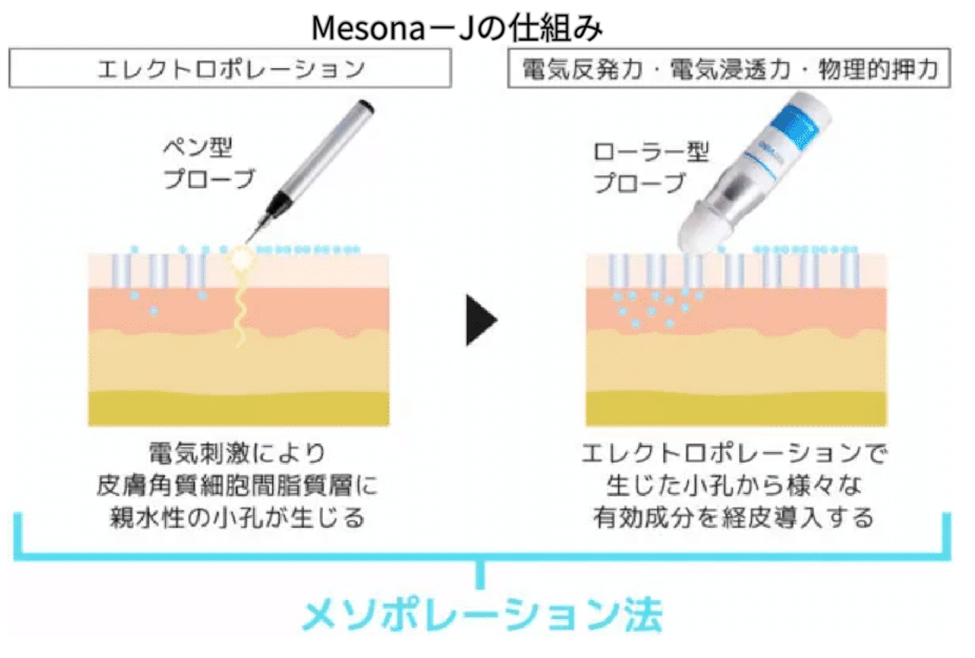 Mesona-Jとは